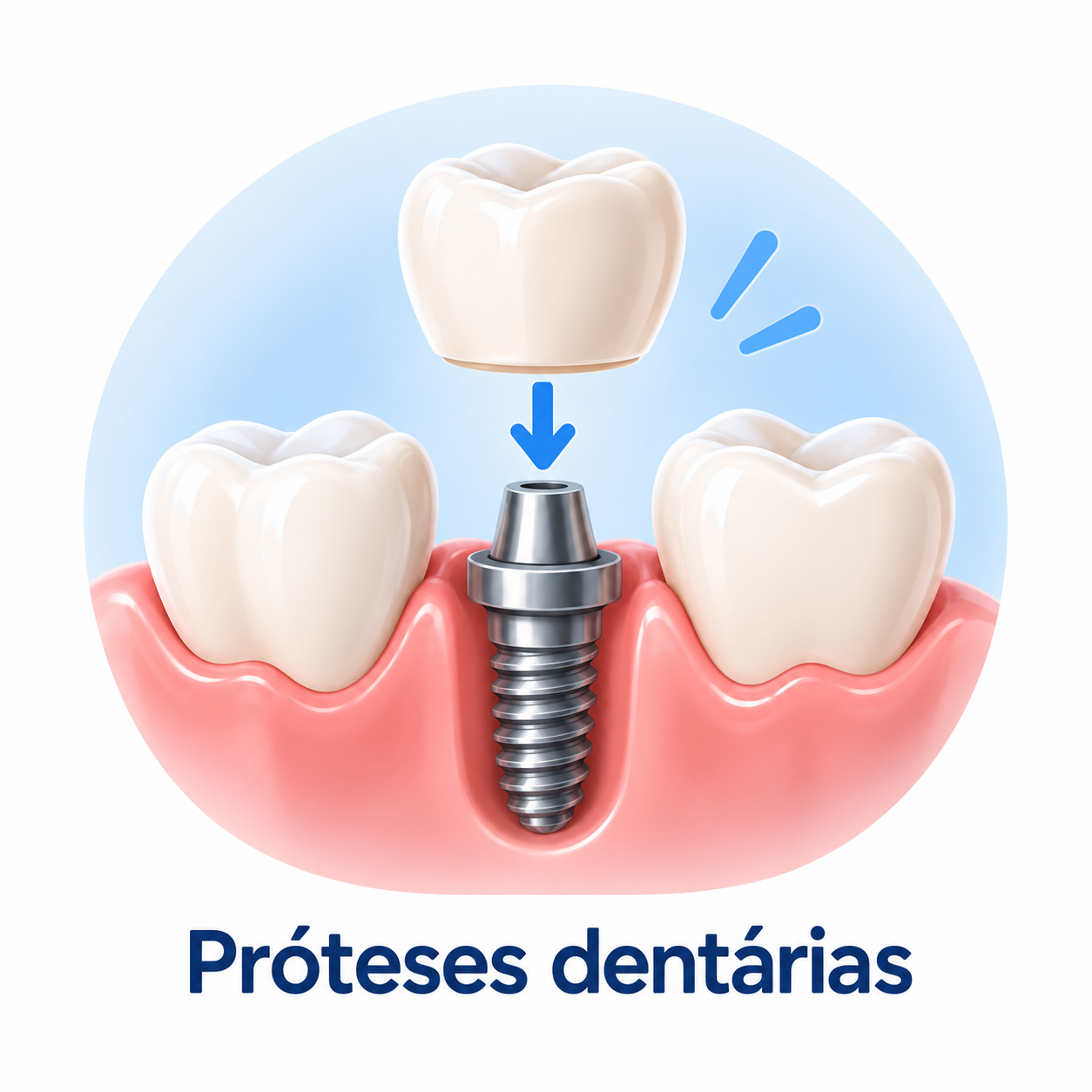 Próteses dentárias