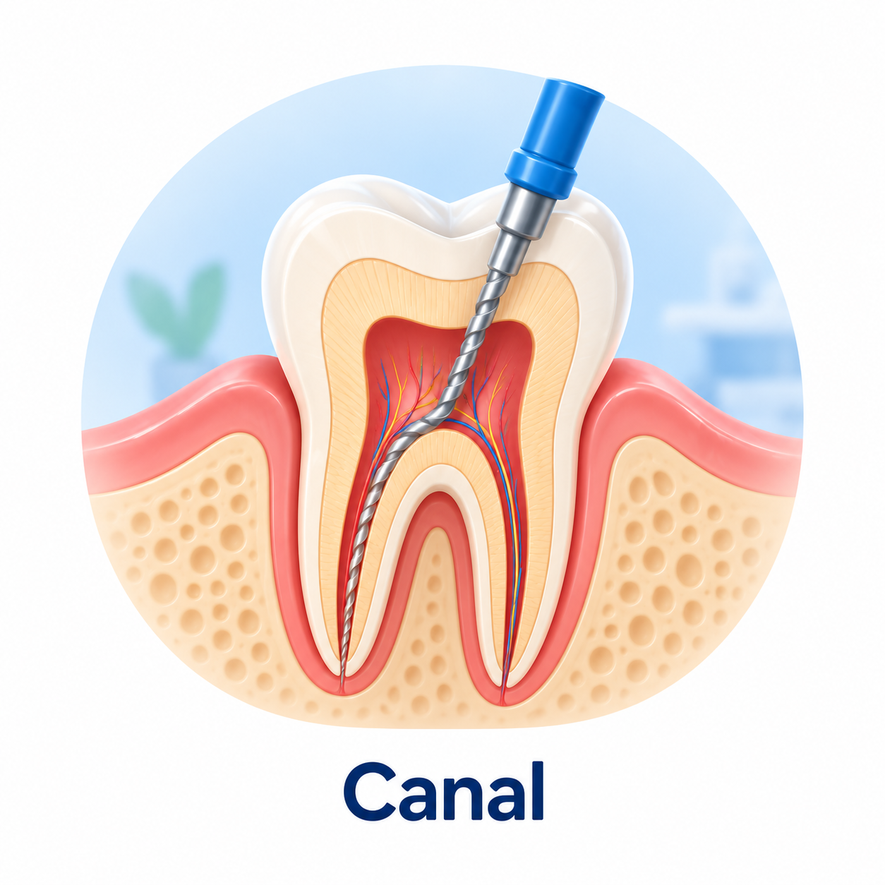 Canal